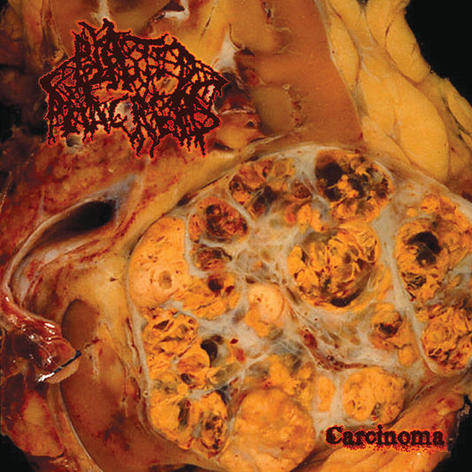 Carcinoma [Colored Vinyl] [Limited Edition] (Red)