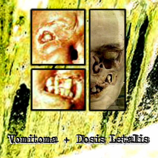 Vomitoma + Dosis Letalis – Painting The Walls With Vomit Cassette